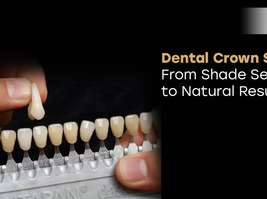 Dental Crown Shades