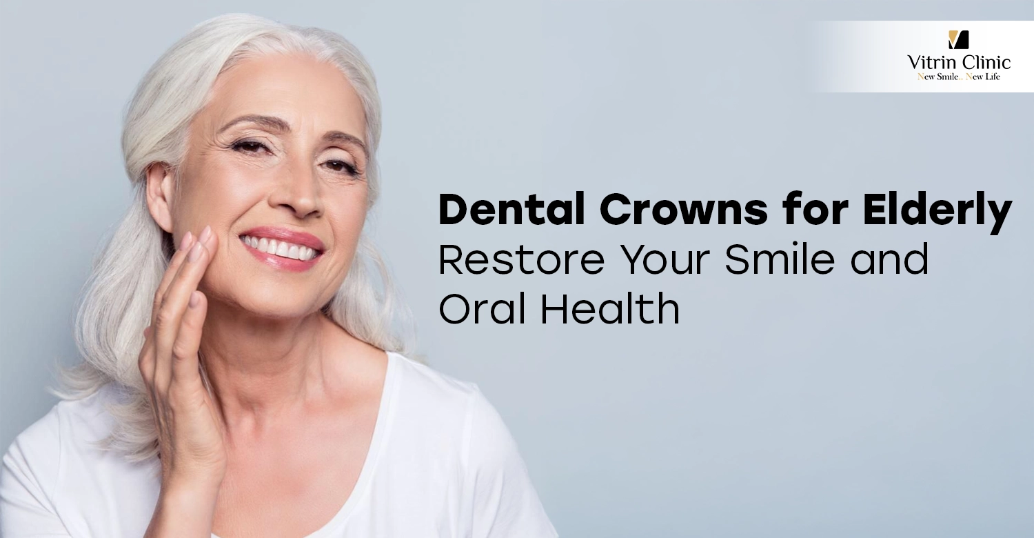 Dental Crowns for Elderly