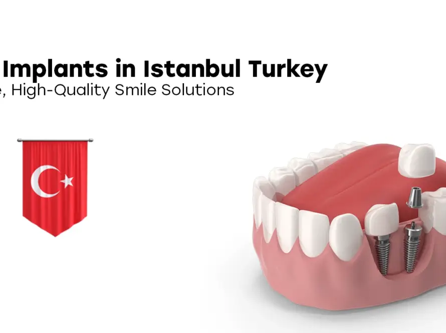 Dental Implants in Istanbul Turkey