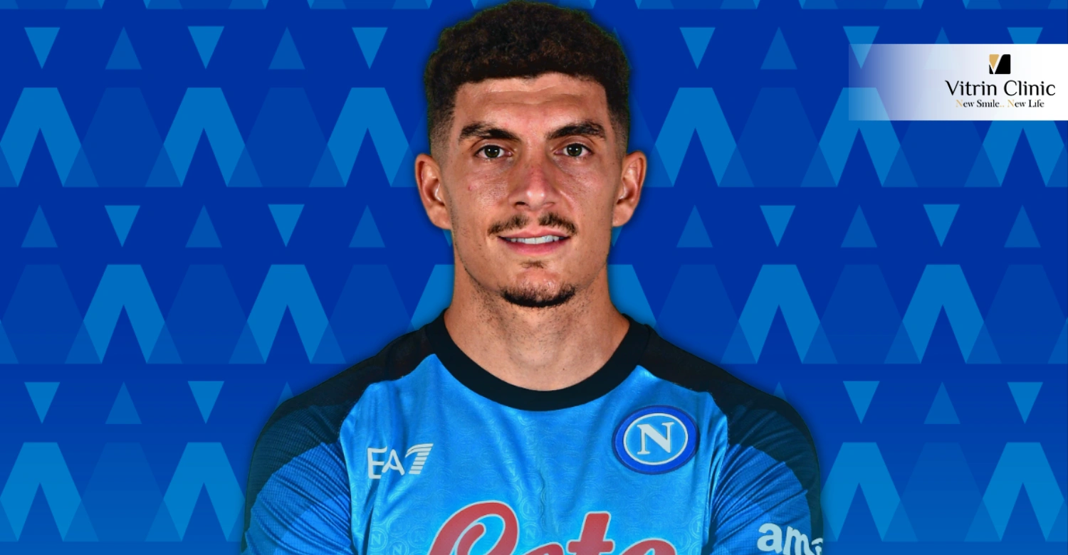 Sorriso di Di Lorenzo