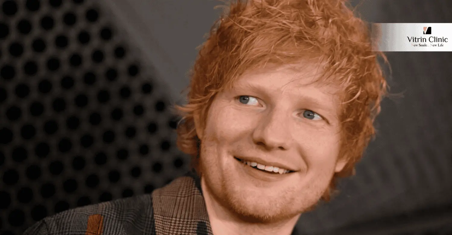 Ed Sheeran smile