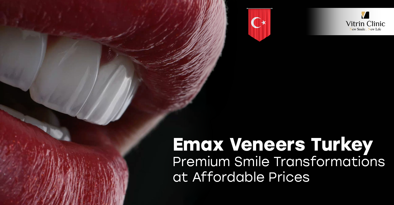 Emax Veneers Turkey