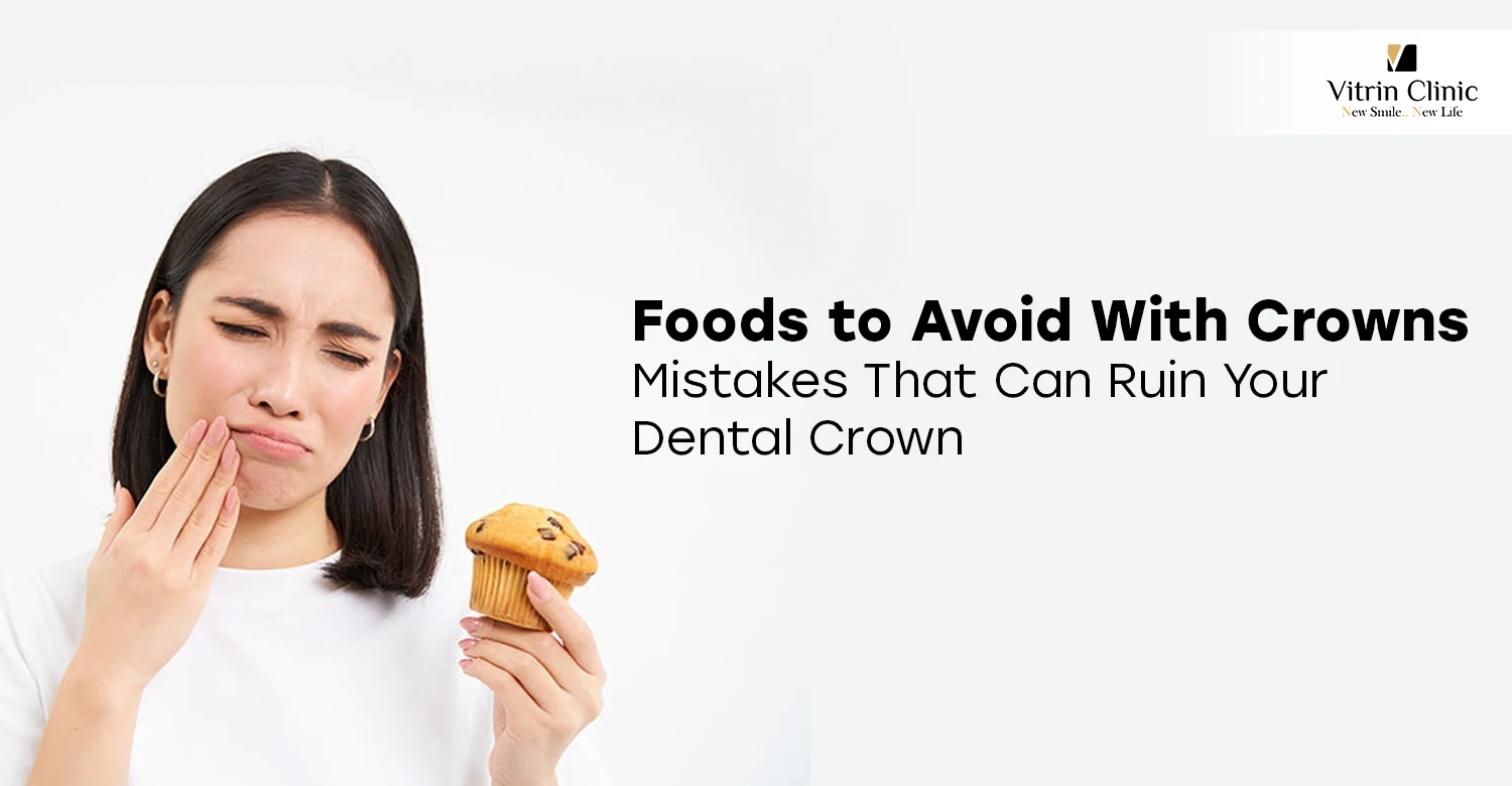 Foods to Avoid With Crowns