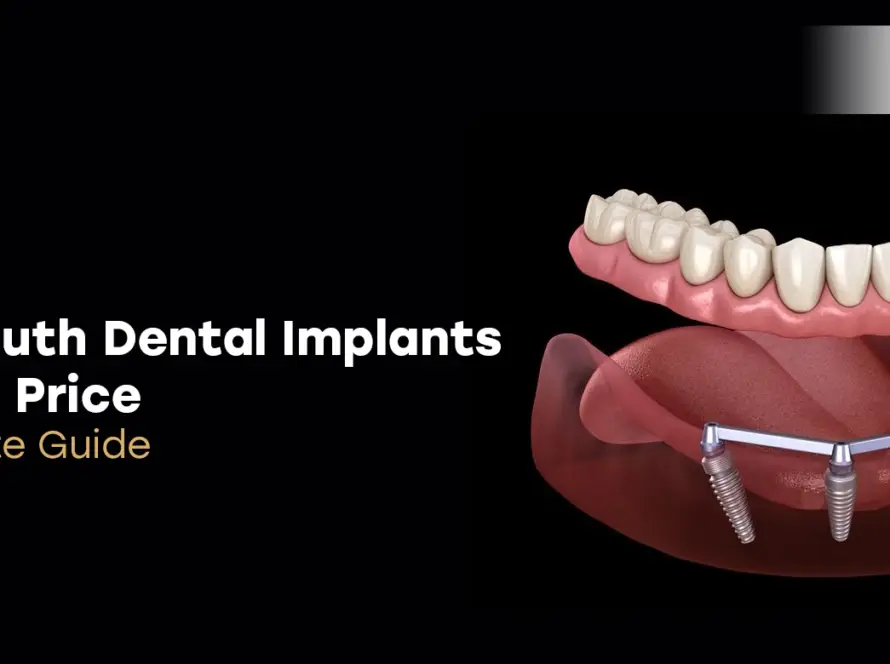 Full Mouth Dental Implants Turkey Price