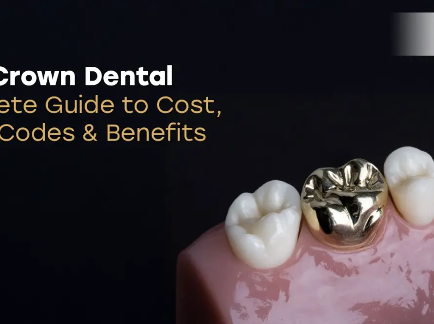 Gold Crown Dental Code: Guide to Costs & Value | Vitrin Clinic