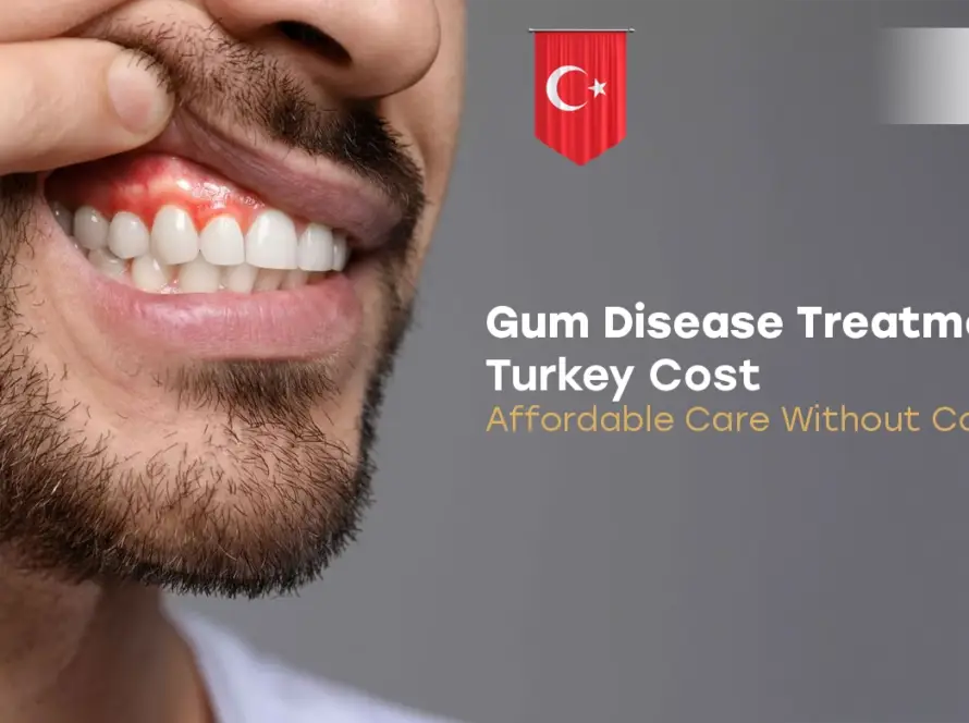 Gum Disease Treatment Turkey Cost
