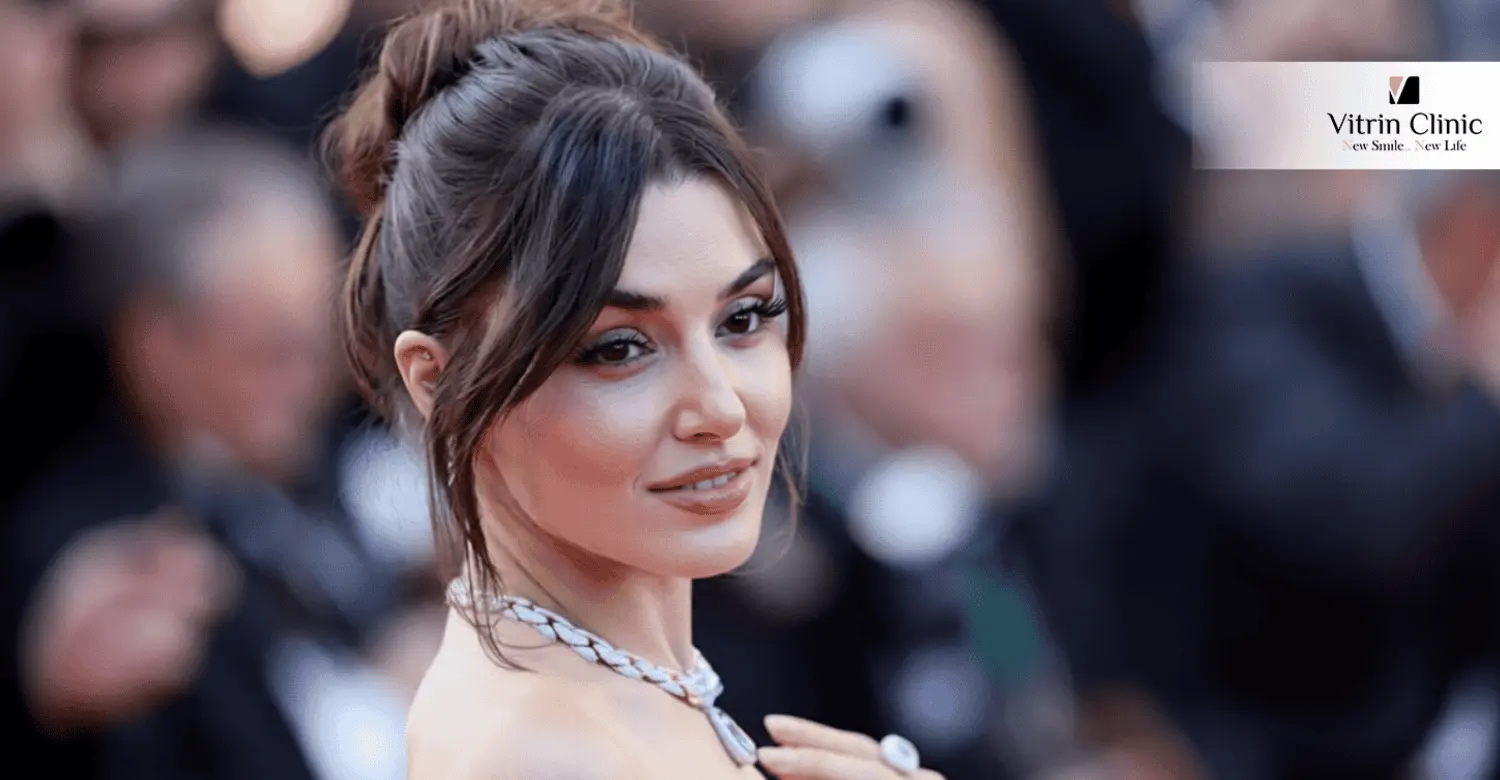 Hande Erçel Gülüşü