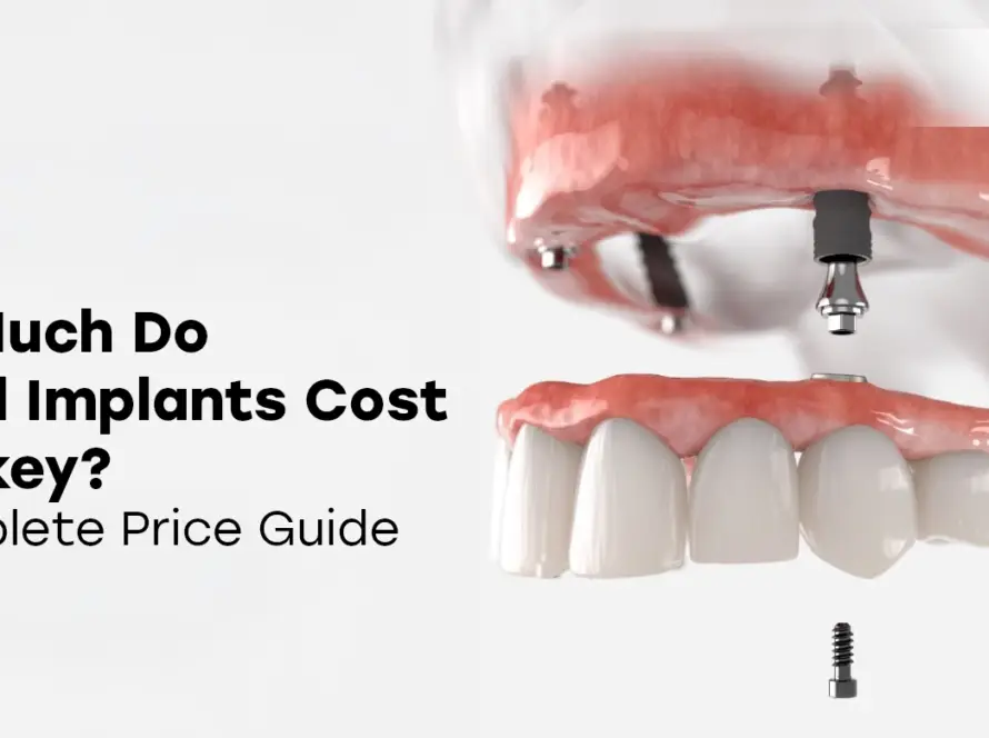 How Much Do Dental Implants Cost in Turkey