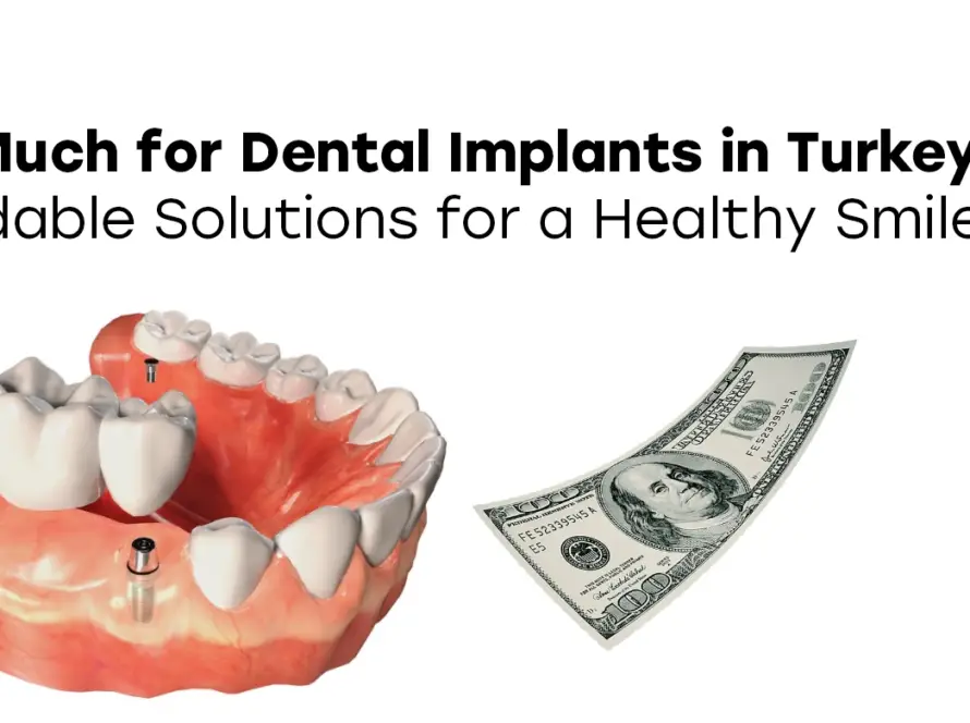 How Much for Dental Implants in Turkey