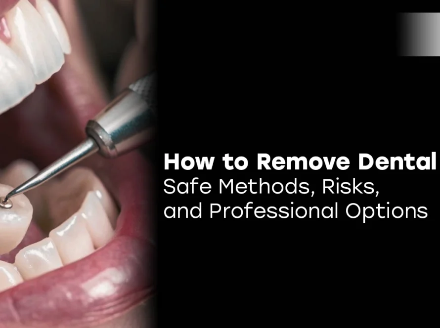 How to Remove Dental Crown