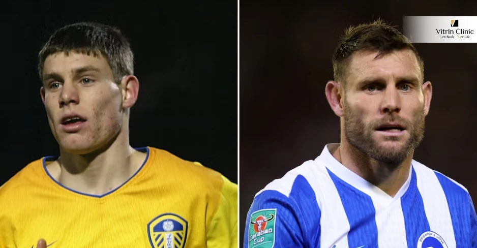 James Milner Dental Transformation: A Look at His Before and After Smile