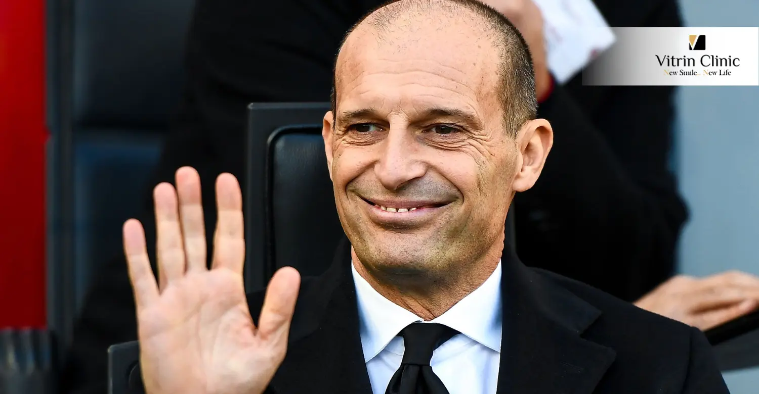 Denti di Massimiliano Allegri: