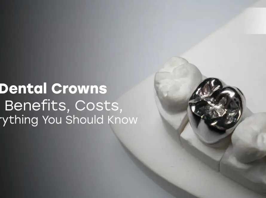 Metal Dental Crowns