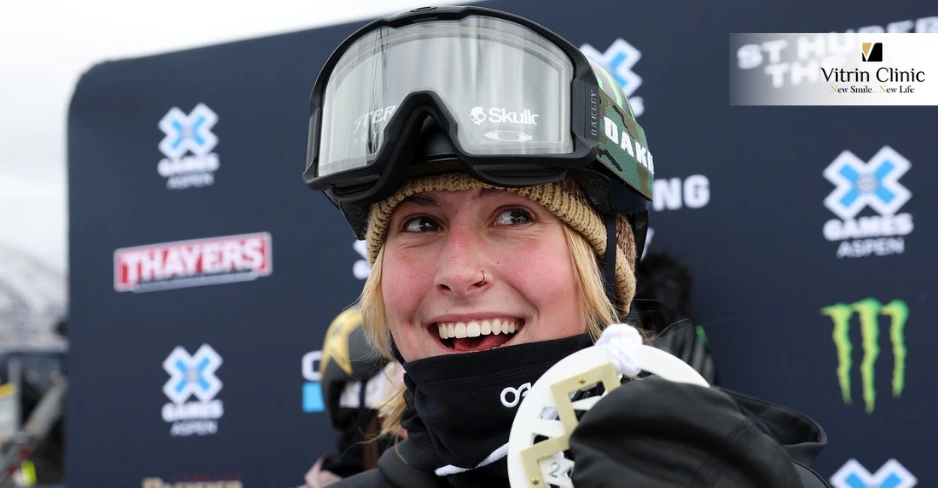 Mia Brookes Smile