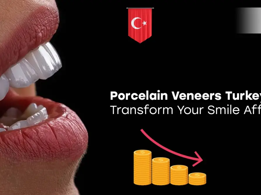Porcelain Veneers Turkey Cost