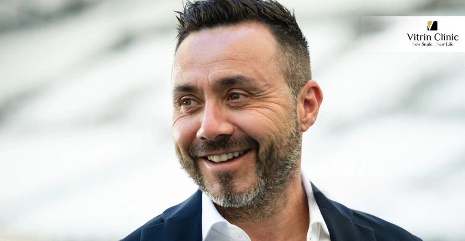 Sourire de Roberto De Zerbi
