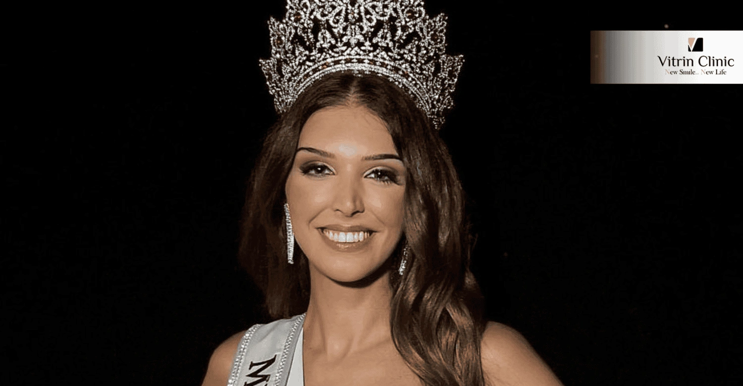 Sorriso de Marina Machete