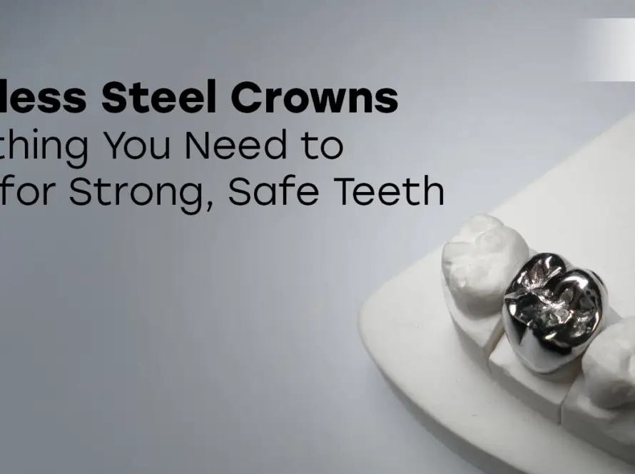 Stainless Steel Crowns