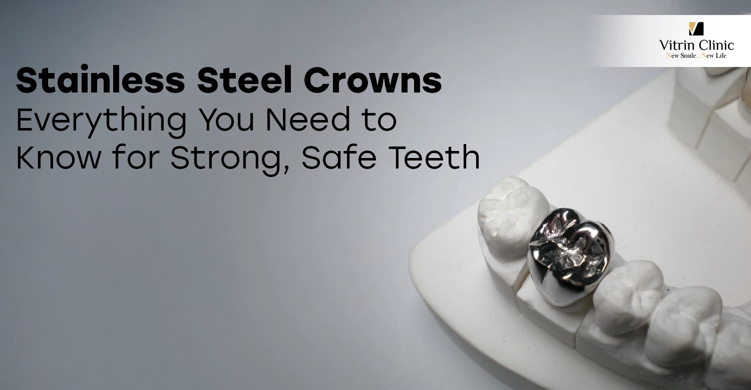 Stainless Steel Crowns