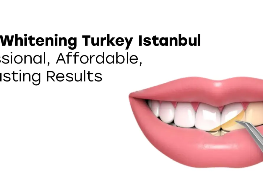 Teeth Whitening Turkey Istanbul