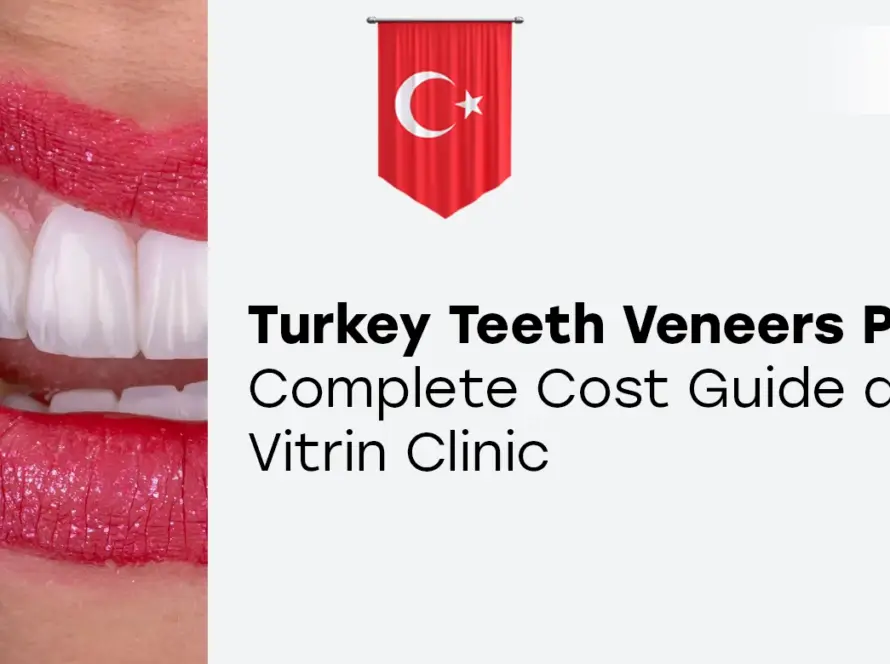 Turkey Teeth Veneers Price