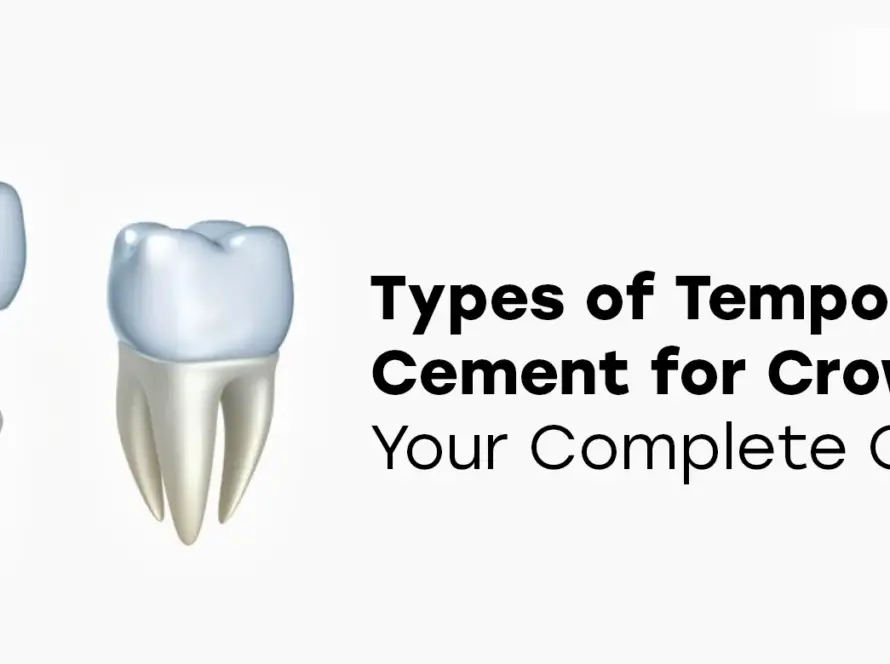 types of temporary cement for crown