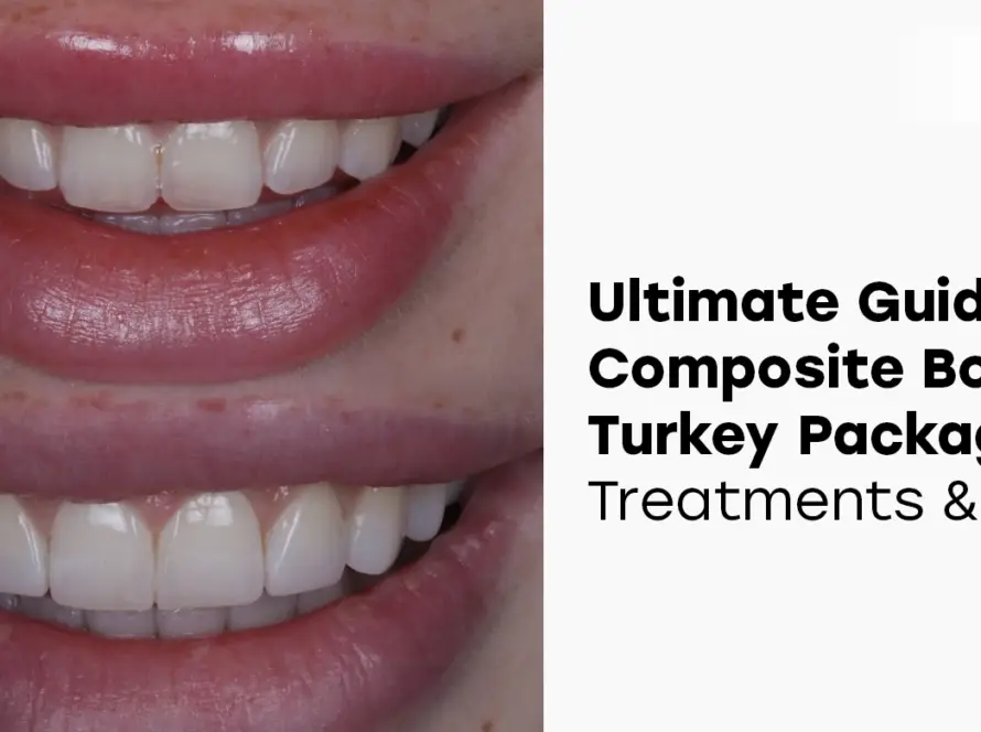 composite bonding turkey packages