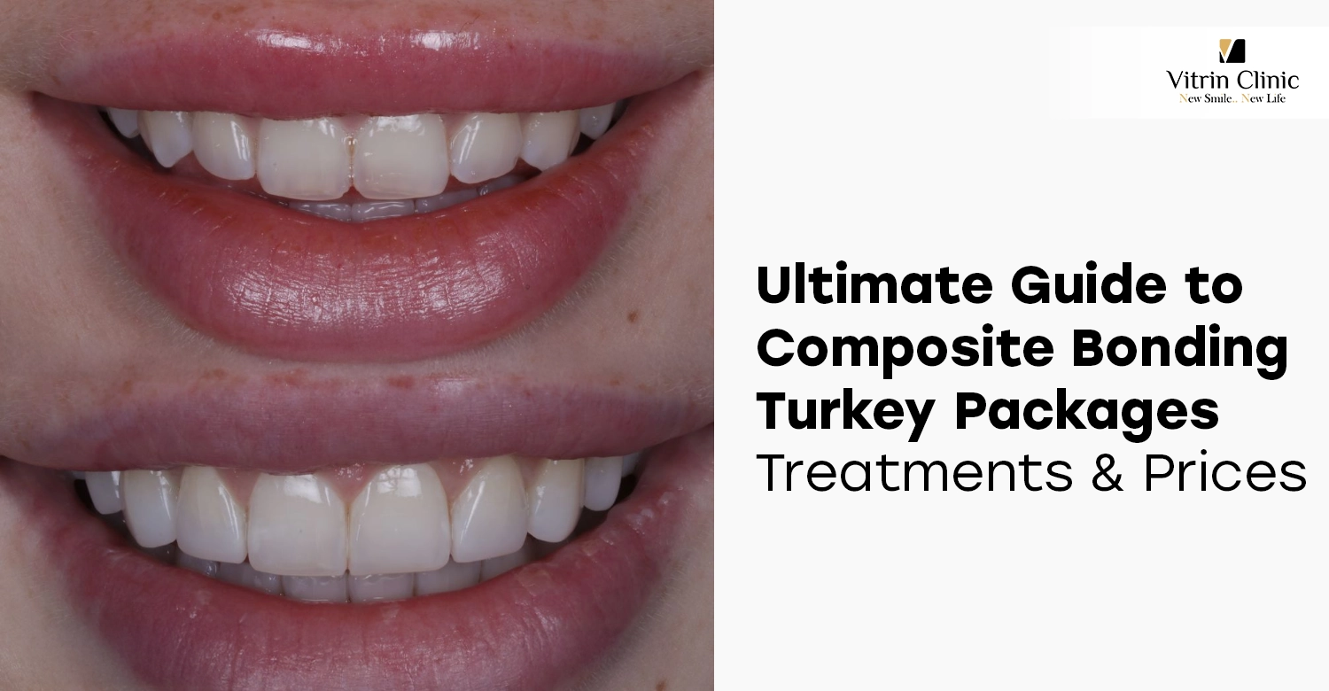 composite bonding turkey packages