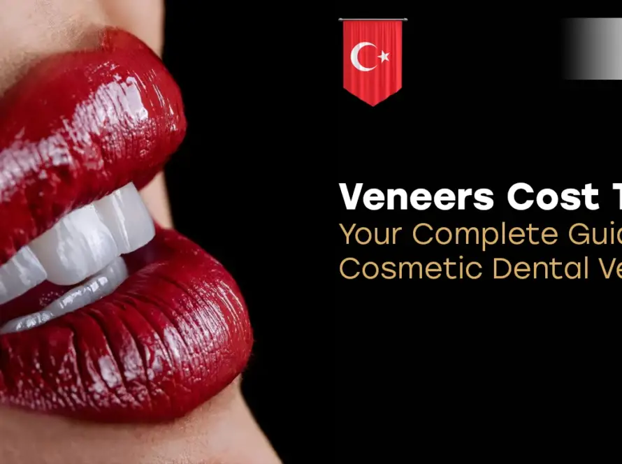 Veneers Cost Turkey