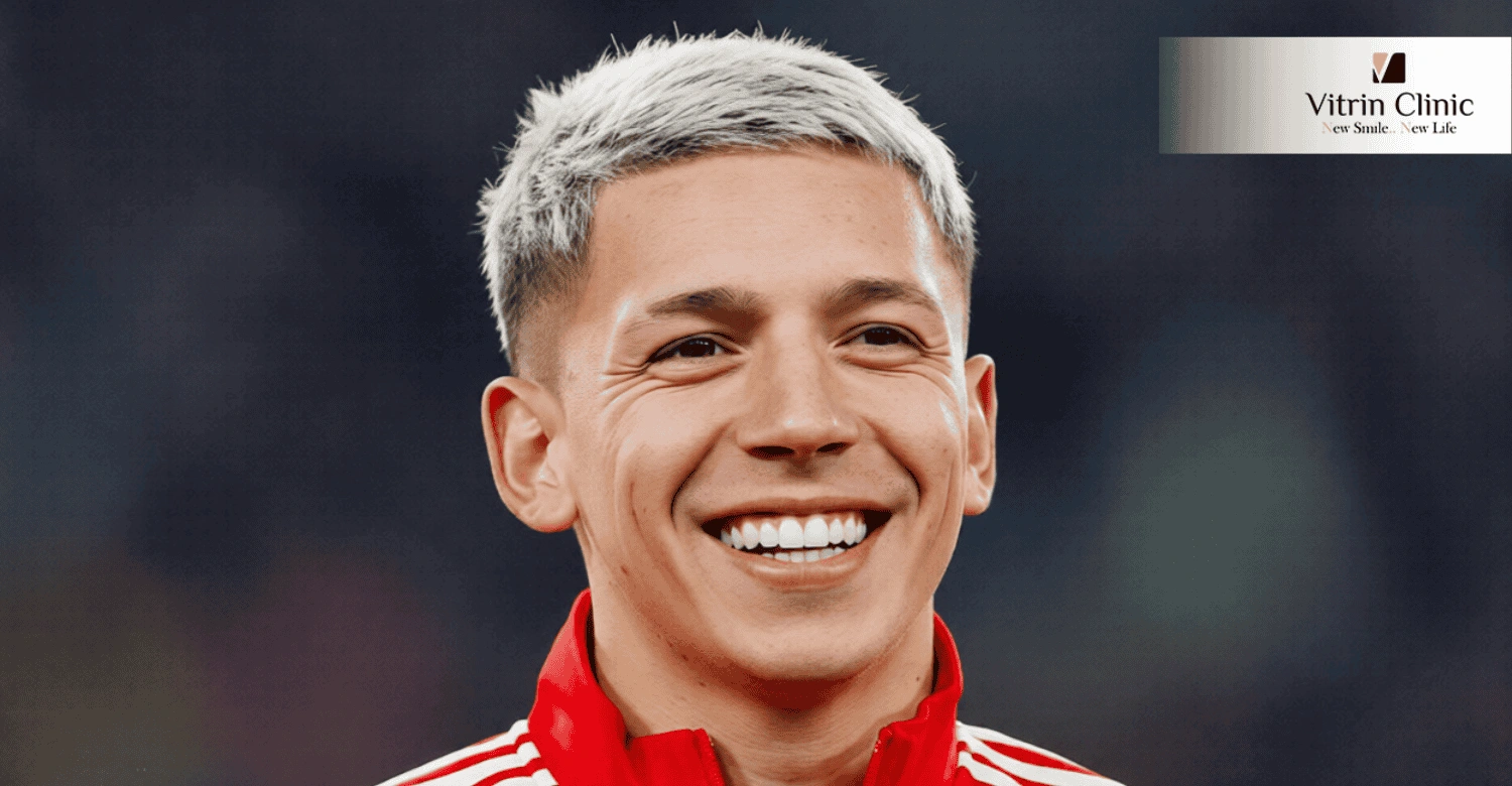 Sorriso de Benfica Prestianni