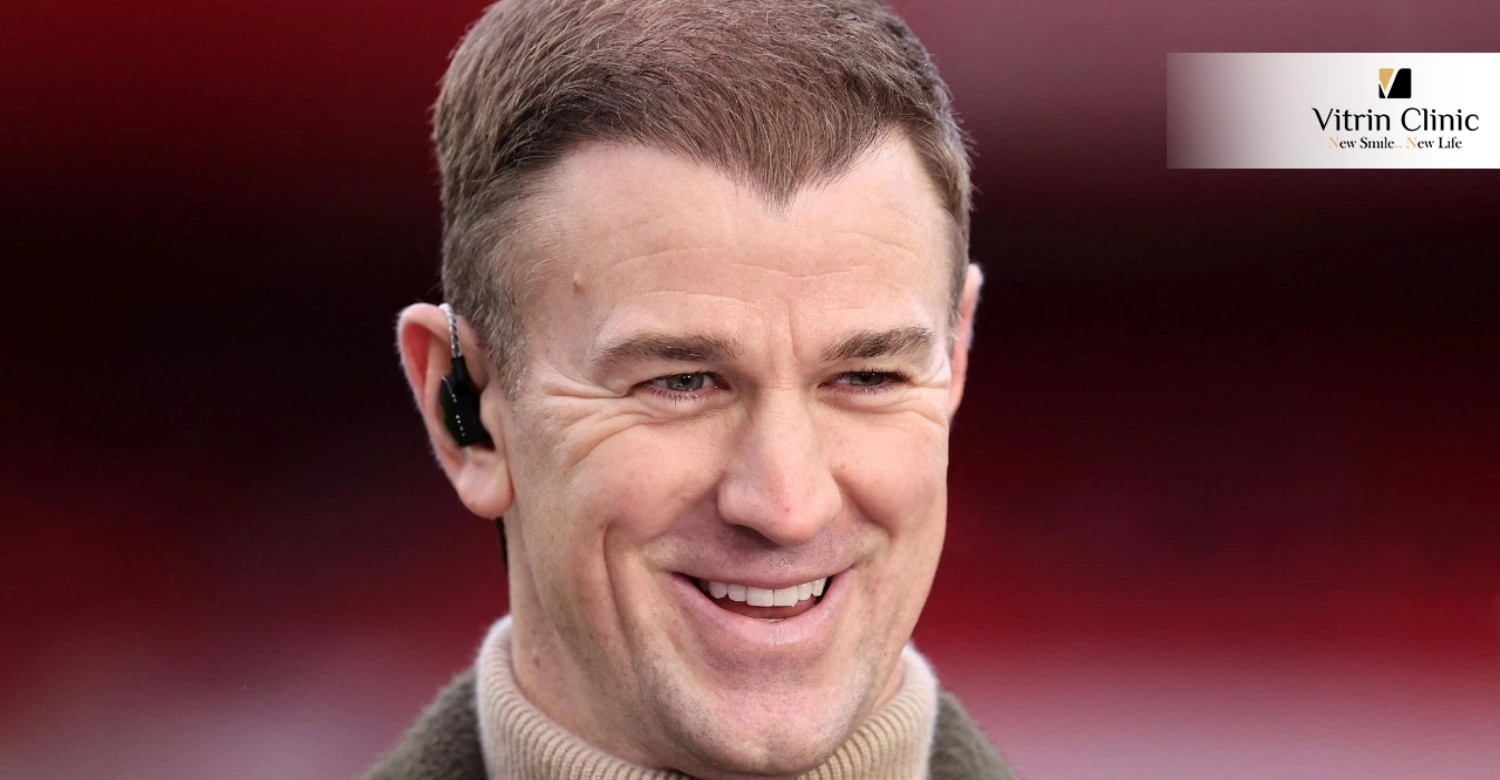 Joe Hart Before and After Smile: Subtle Maturity or Strategic Refinement?
