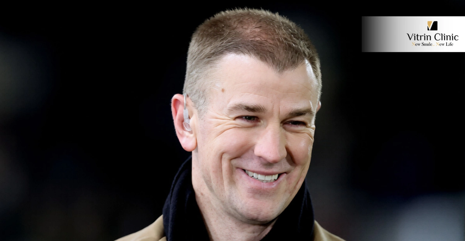 Joe Hart Smile