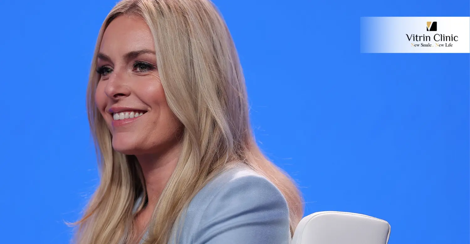 Lindsey Vonn Smile