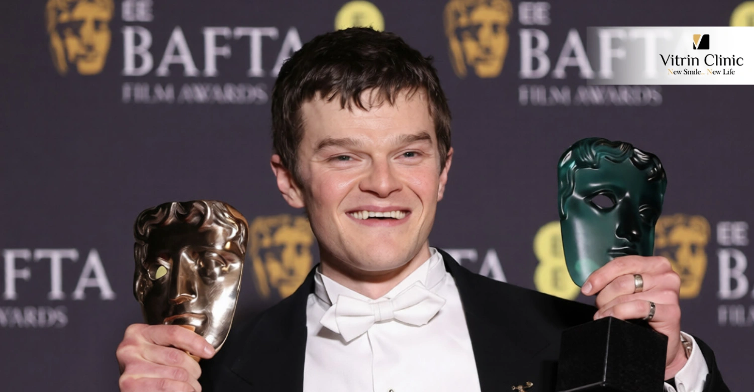 Robert Aramayo smile