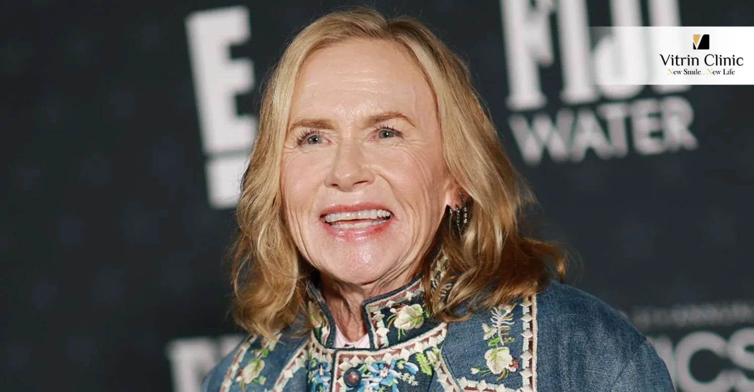 Amy Madigan Hollywood Smile: What Makes It Iconic