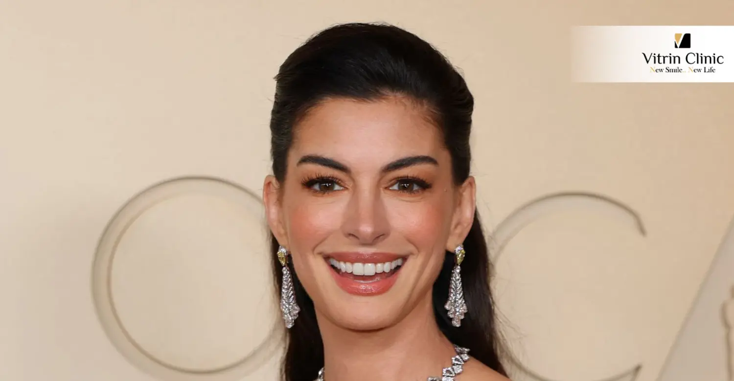 Anne Hathaway Smile Makeover: Has It Changed Over Time?