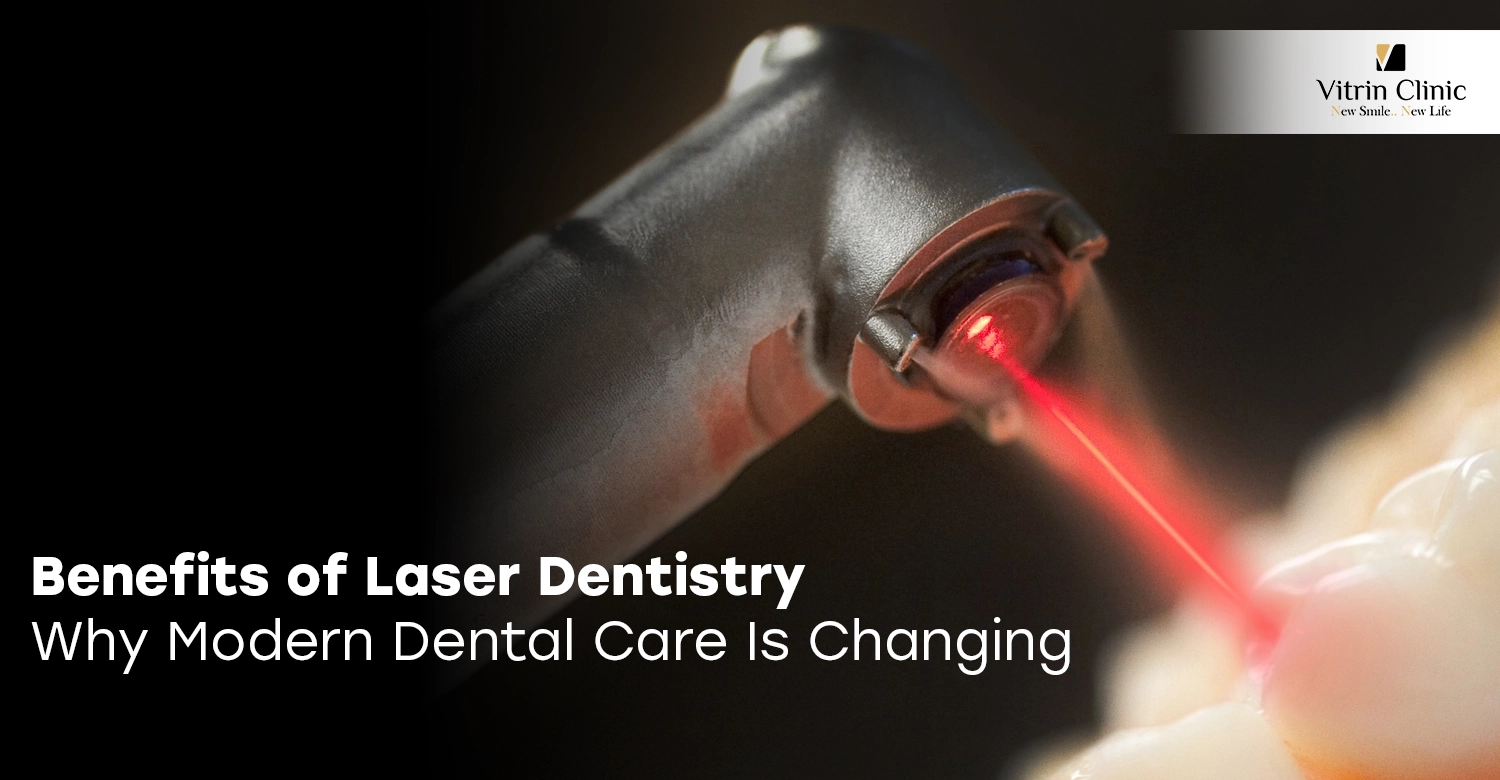 Benefits of Laser Dentistry