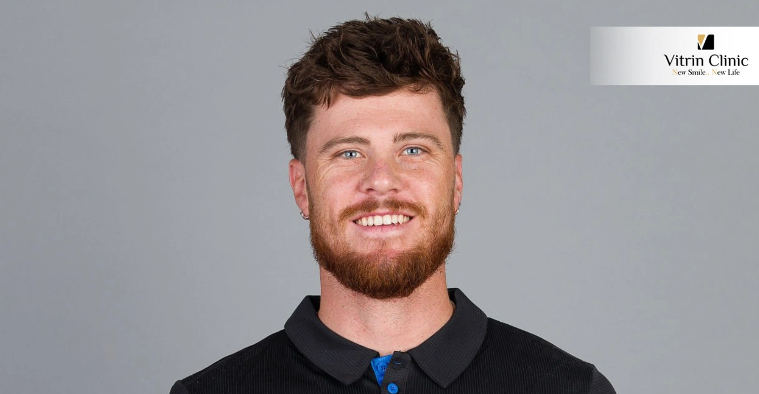 Finn Allen Smile