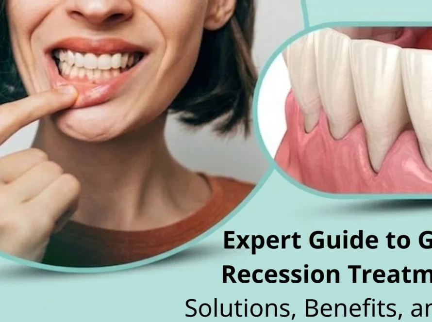 Gum Recession Treatment