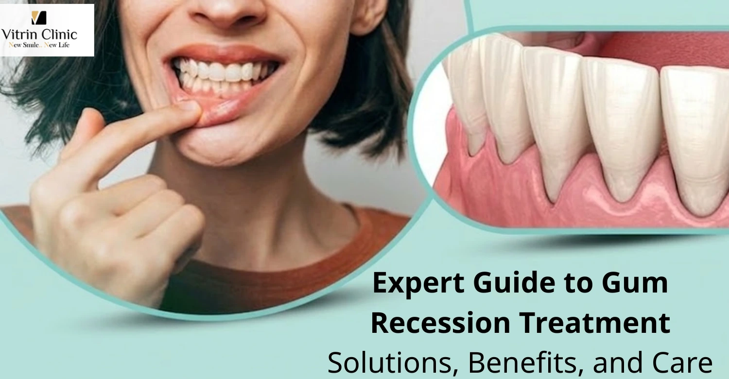 Gum Recession Treatment