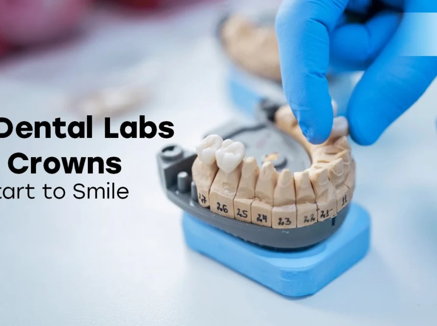 How Dental Labs Make Crowns