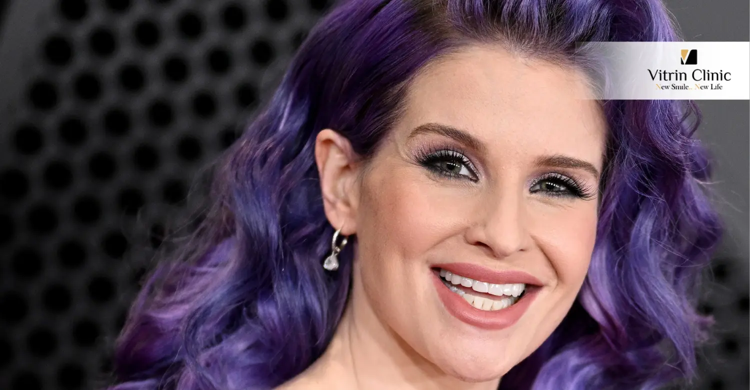 Kelly Osbourne Smile