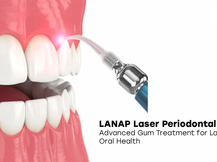 LANAP Laser Periodontal Therapy