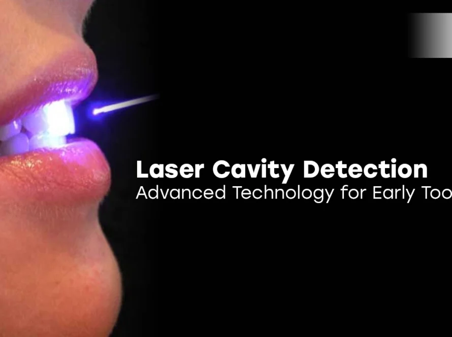Laser Cavity Detection