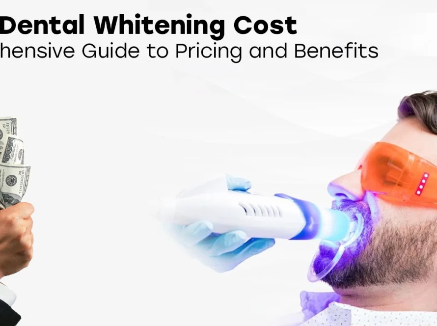 Laser Dental Whitening Cost