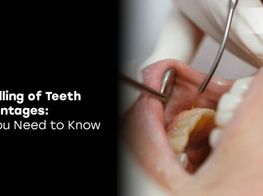 Laser Filling of Teeth Disadvantages