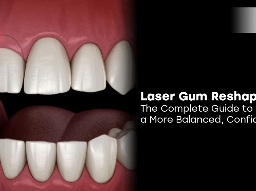 Laser Gum Reshaping