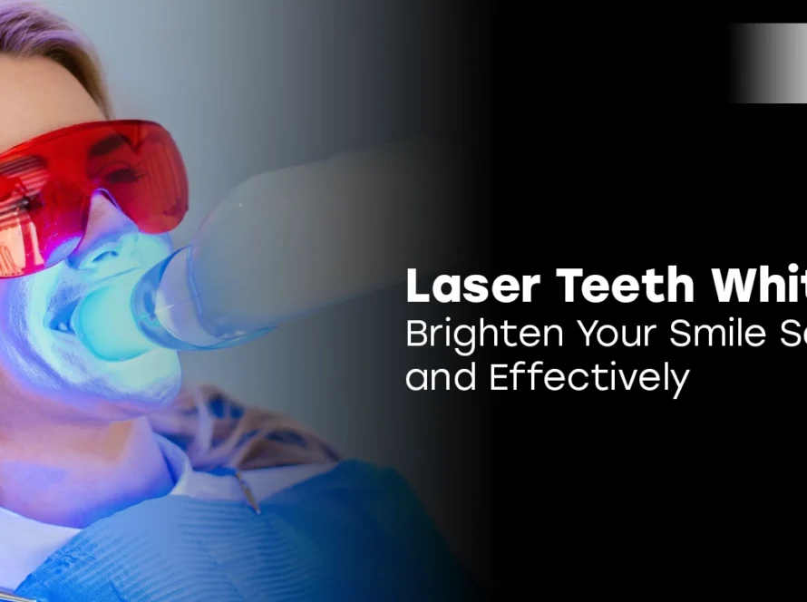 Laser Teeth Whitening