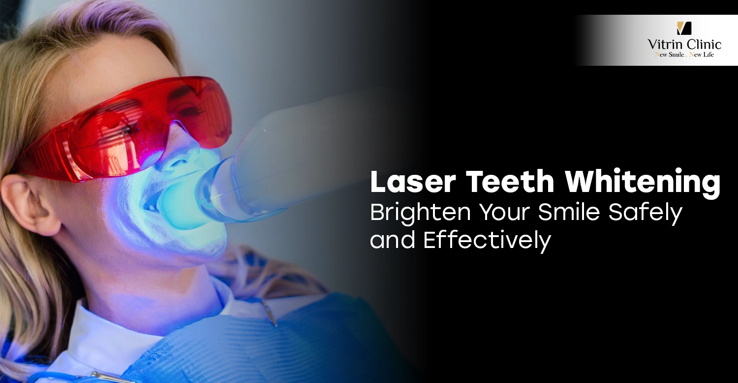 Laser Teeth Whitening