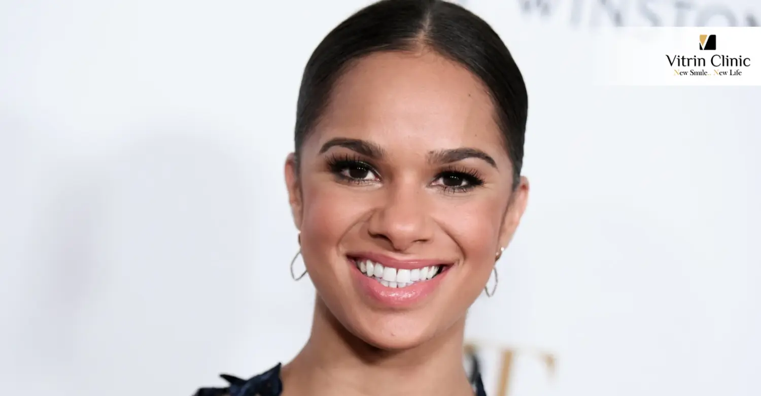 Misty Copeland Smile